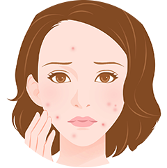 ニキビ・肌荒れが気になる女性のイラスト